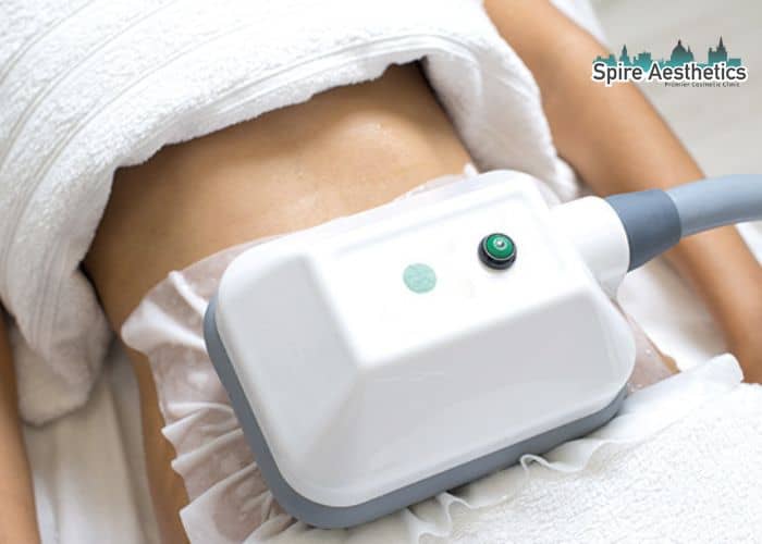 Shift Those Extra Pounds: How Fat Freezing Can Help You Slim Down Murrayfield