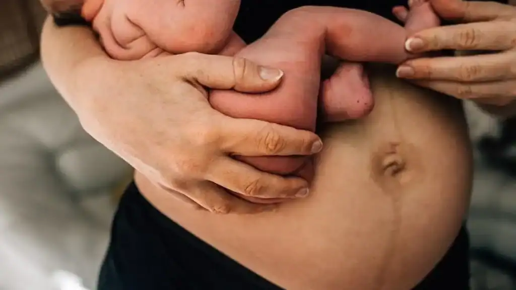 Why Is My Stomach Still Big After Pregnancy Murrayfield?